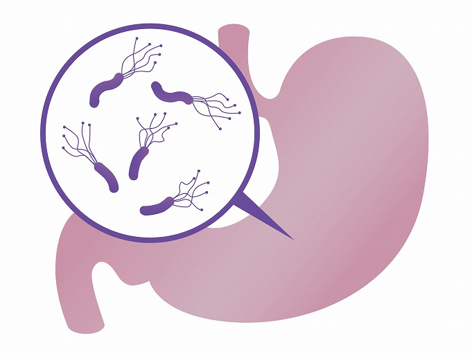 性 血小板 紫斑 性 芸能人 病 特発 減少 特発性血小板減少性紫斑病（ITP）とは